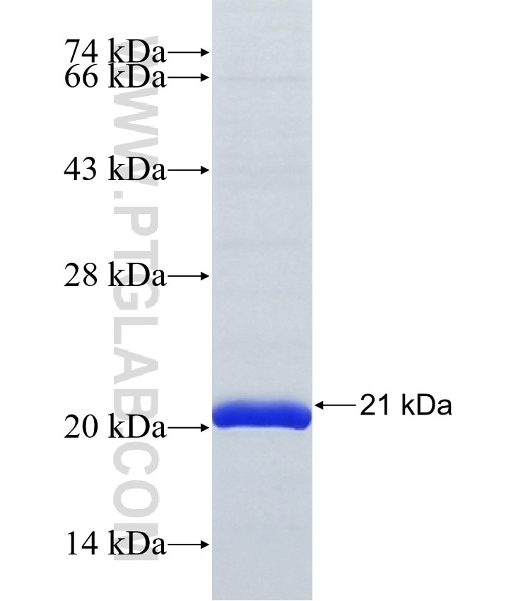 ASB12 fusion protein Ag37012 SDS-PAGE ASB12 fusion protein Ag37012 SDS-PAGE