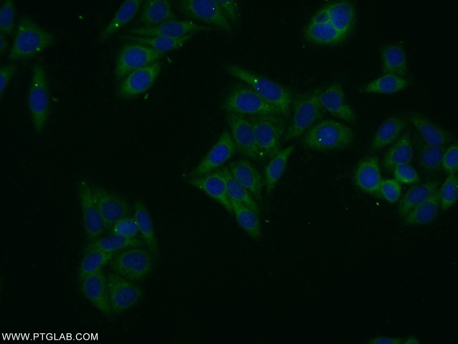 Immunofluorescence (IF) / fluorescent staining of HepG2 cells using ASB13 Polyclonal antibody (25616-1-AP)