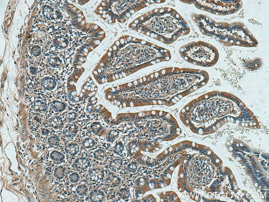Immunohistochemistry (IHC) staining of human small intestine tissue using ASB13 Polyclonal antibody (25616-1-AP)