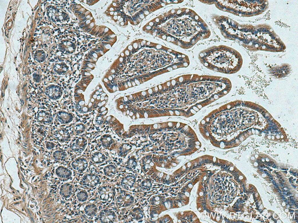 IHC staining of human small intestine using 25616-1-AP