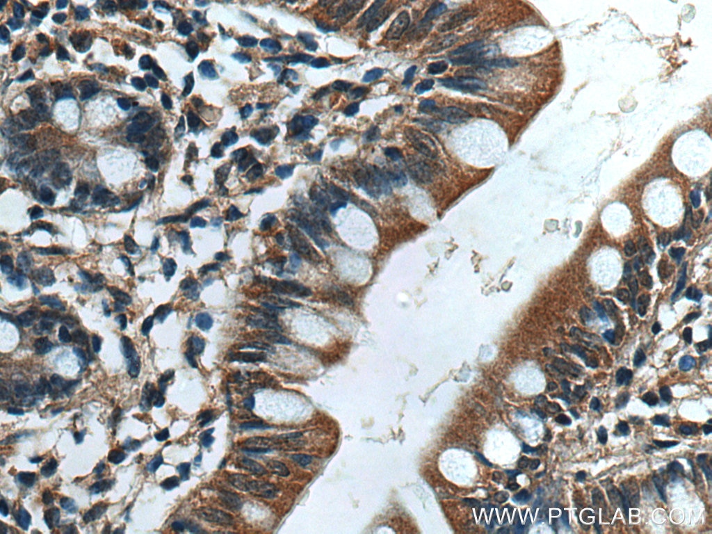Immunohistochemistry (IHC) staining of human small intestine tissue using ASB13 Polyclonal antibody (25616-1-AP)