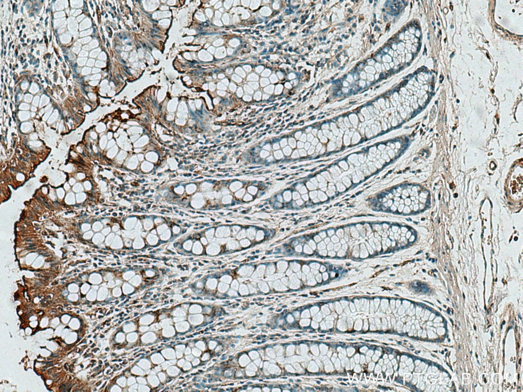 Immunohistochemistry (IHC) staining of human colon tissue using ASB13 Polyclonal antibody (25616-1-AP)