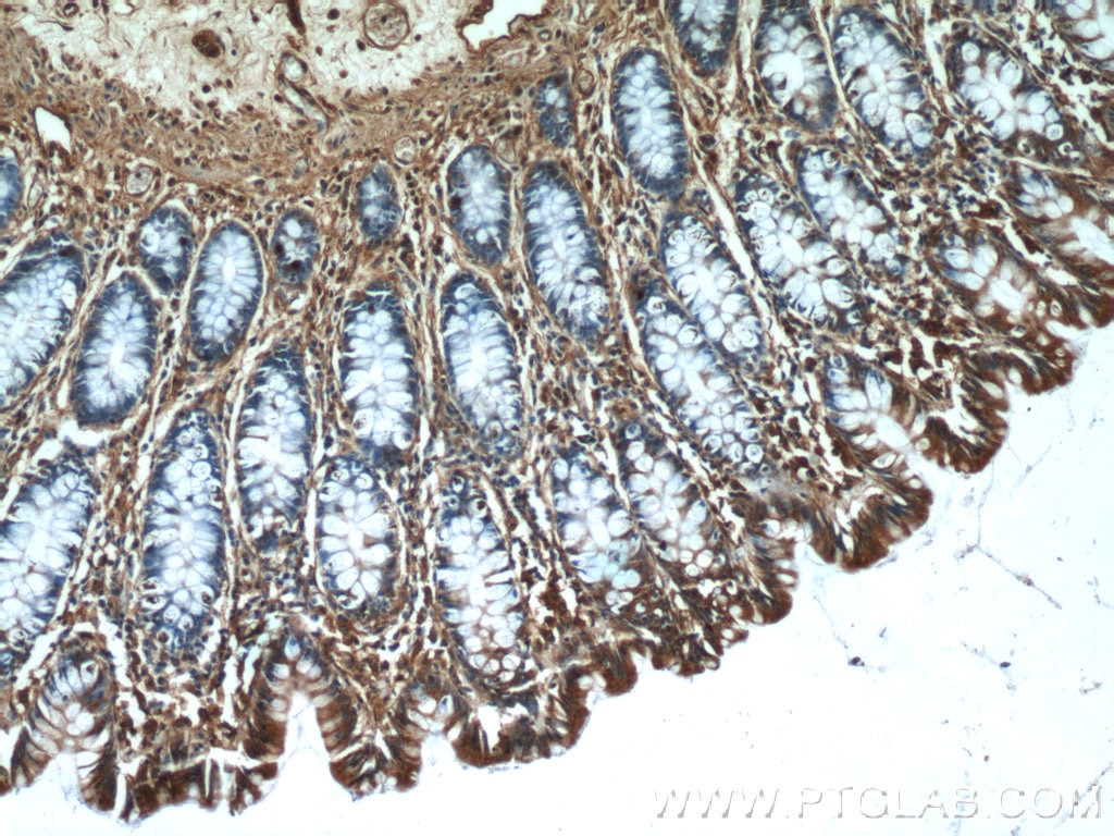 IHC staining of human colon using 25616-1-AP