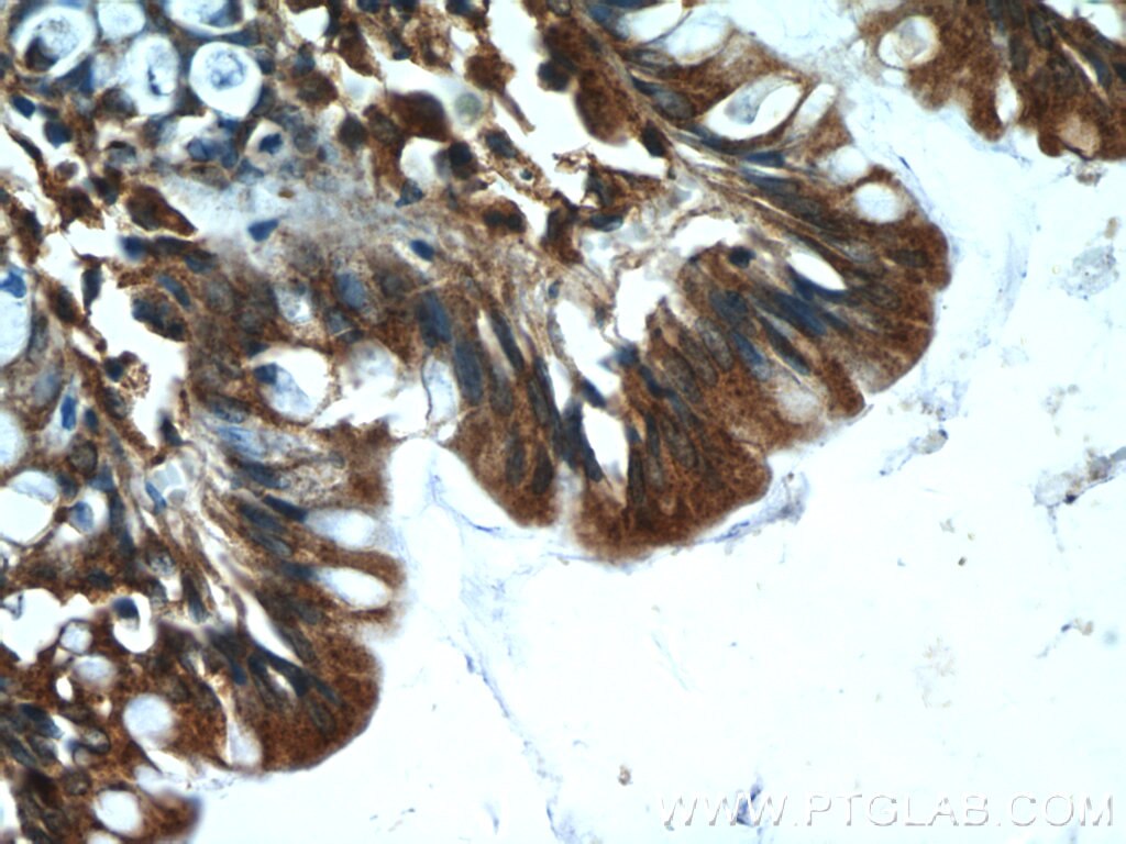 IHC staining of human colon using 25616-1-AP