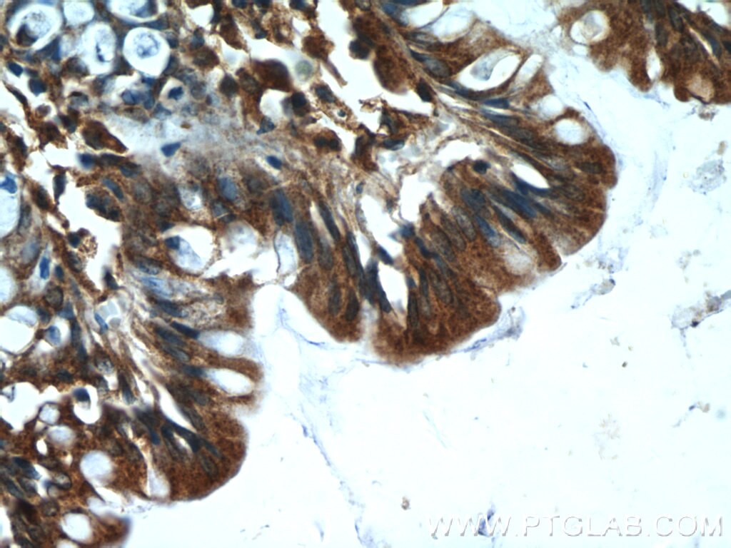 Immunohistochemistry (IHC) staining of human colon tissue using ASB13 Polyclonal antibody (25616-1-AP)