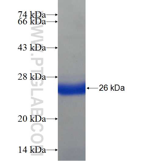 ASB13 fusion protein Ag22533 SDS-PAGE