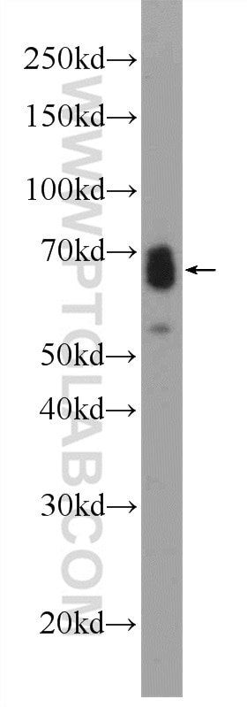 Western Blot (WB) analysis of mouse spleen tissue using ASB14 Polyclonal antibody (25300-1-AP)