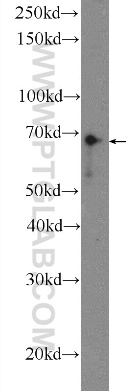 Western Blot (WB) analysis of Raji cells using ASB14 Polyclonal antibody (25300-1-AP)