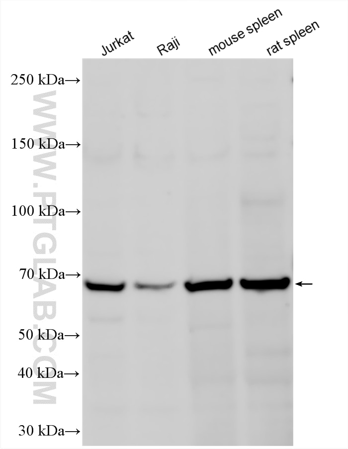 WB analysis using 25300-1-AP (same clone as 25300-1-PBS) Western Blot (WB) analysis of various lysates using ASB14 Polyclonal antibody (25300-1-AP)