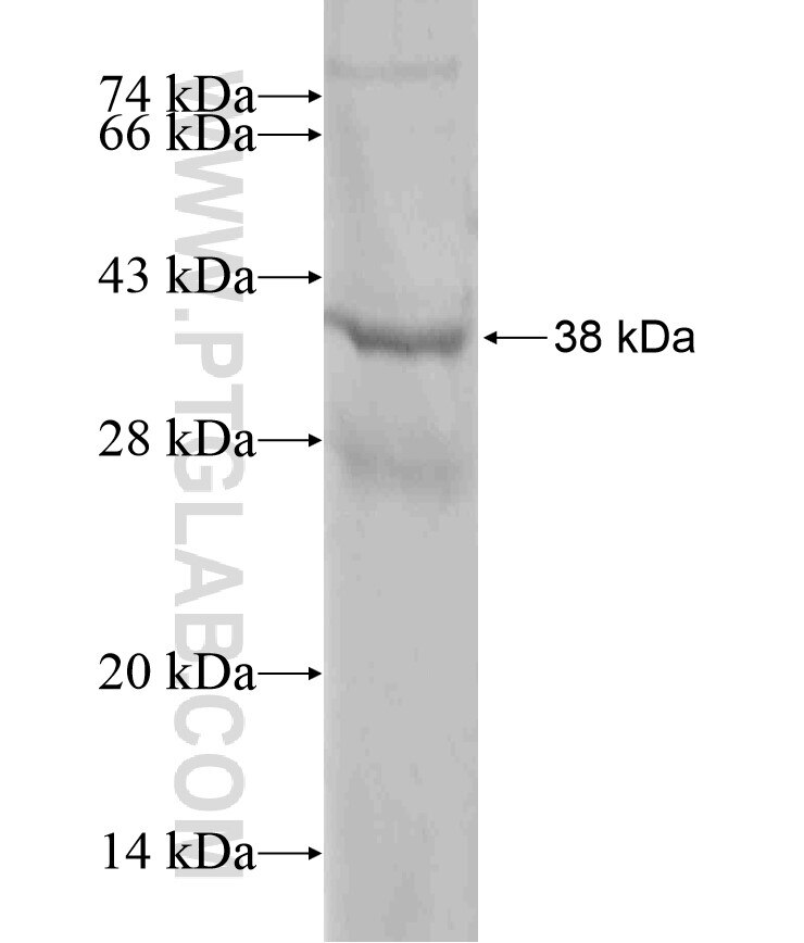ASB14 fusion protein Ag18107 SDS-PAGE ASB14 fusion protein Ag18107 SDS-PAGE