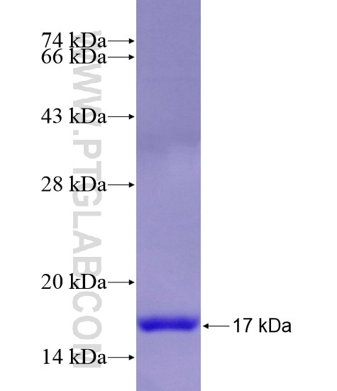 ASB17 fusion protein Ag28867 SDS-PAGE