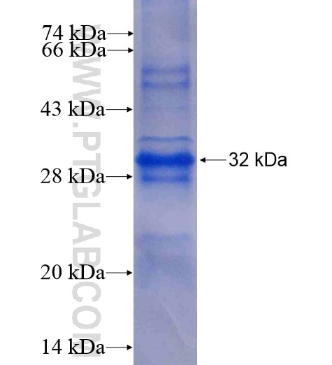 ASB17 fusion protein Ag6629 SDS-PAGE