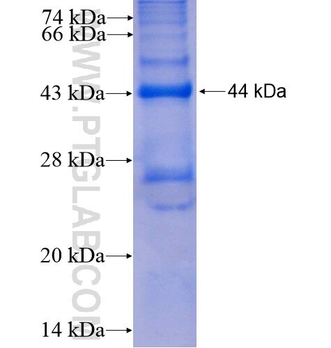ASB2 fusion protein Ag6009 SDS-PAGE