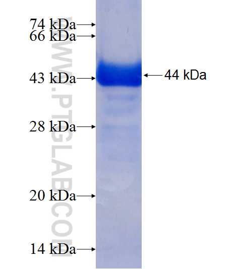 ASB3 fusion protein Ag8031 SDS-PAGE
