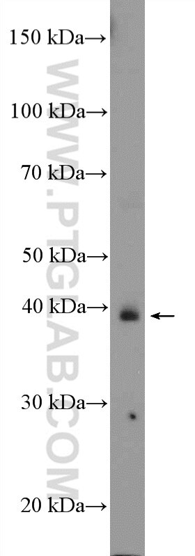 Western Blot (WB) analysis of mouse heart tissue using ASB5 Polyclonal antibody (24031-1-AP)