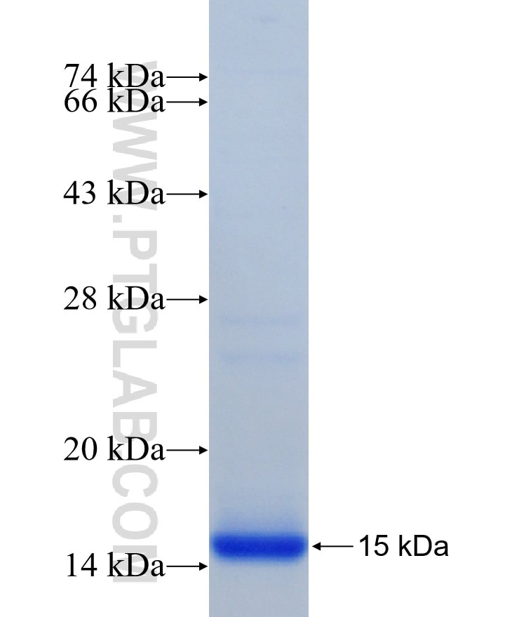 ASB5 fusion protein Ag21230 SDS-PAGE