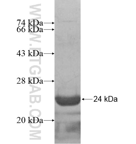 ASB6 fusion protein Ag13863 SDS-PAGE