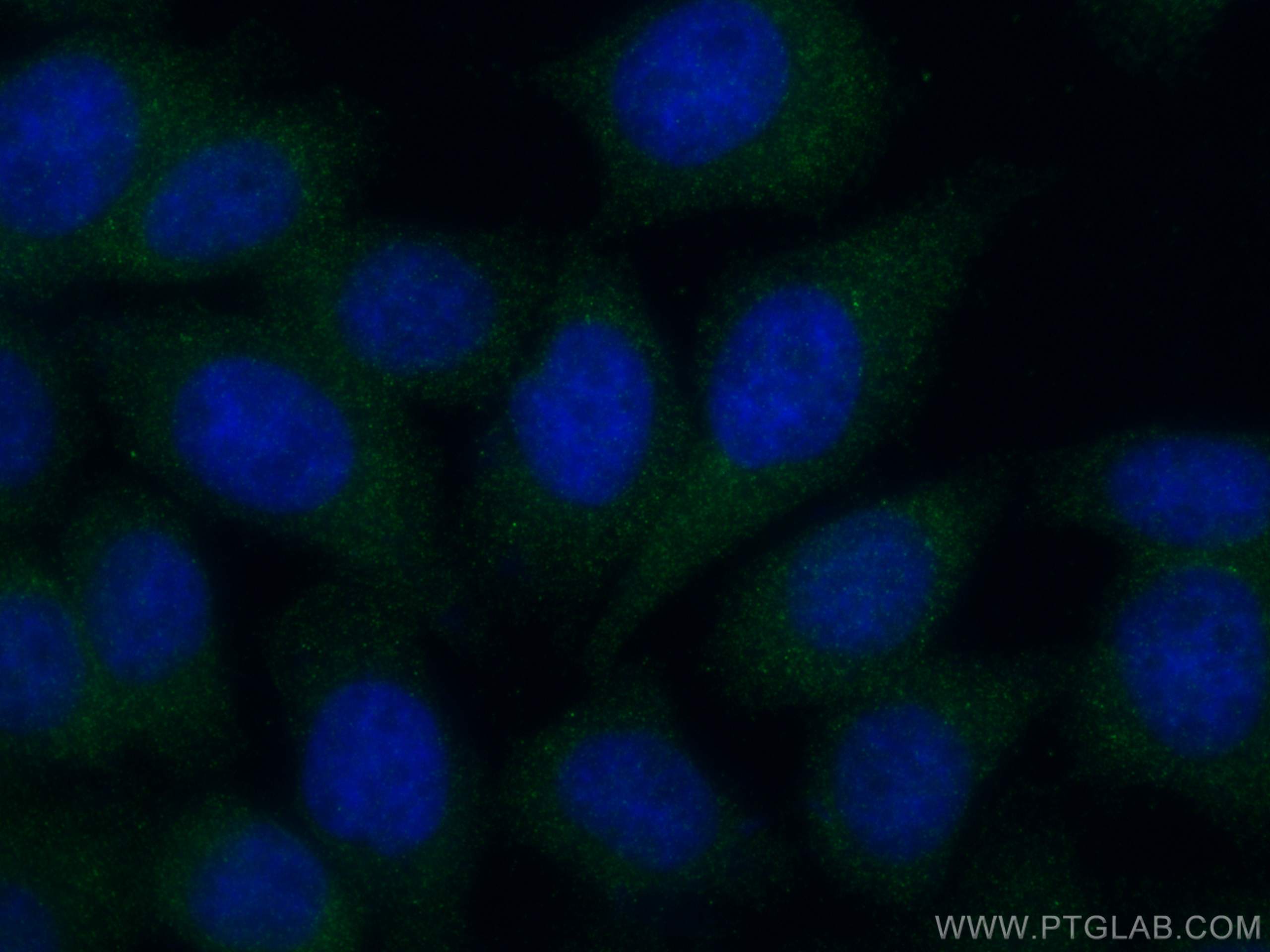 Immunofluorescence (IF) / fluorescent staining of HepG2 cells using ASB8 Polyclonal antibody (11735-1-AP)