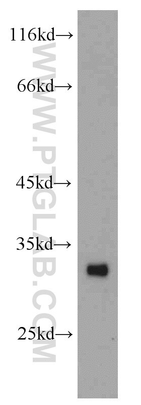 Western Blot (WB) analysis of human heart tissue using ASB8 Polyclonal antibody (11735-1-AP)