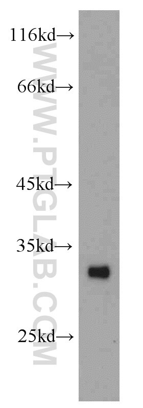 Western Blot (WB) analysis of human heart tissue using ASB8 Polyclonal antibody (11735-1-AP)