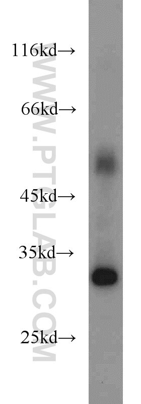 Western Blot (WB) analysis of human heart tissue using ASB8 Polyclonal antibody (11735-1-AP)