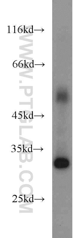 WB analysis of human heart using 11735-1-AP