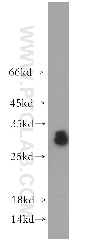 Western Blot (WB) analysis of human testis tissue using ASB9 Polyclonal antibody (11952-1-AP)