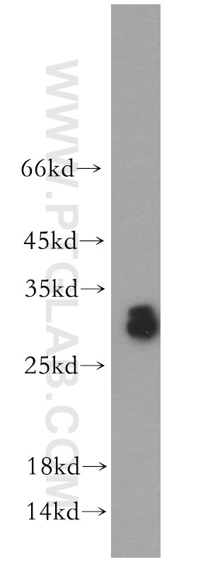 WB analysis of human testis using 11952-1-AP