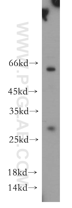 Western Blot (WB) analysis of HepG2 cells using ASB9 Polyclonal antibody (11952-1-AP)