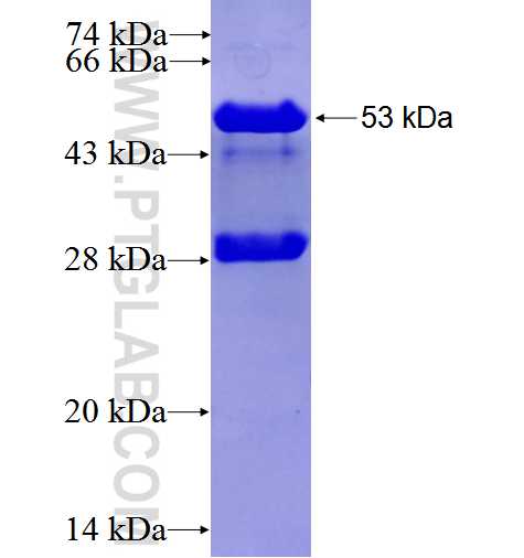 ASB9 fusion protein Ag2554 SDS-PAGE