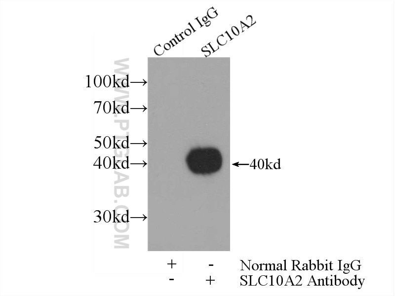 Immunoprecipitation (IP) experiment of mouse kidney tissue using ASBT Polyclonal antibody (25245-1-AP)