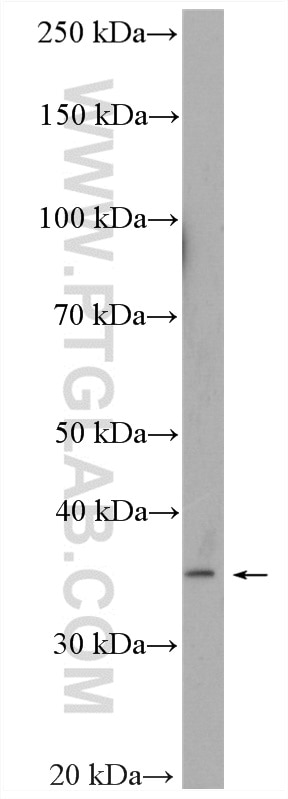 Western Blot (WB) analysis of mouse small intestine tissue using ASBT Polyclonal antibody (25245-1-AP)