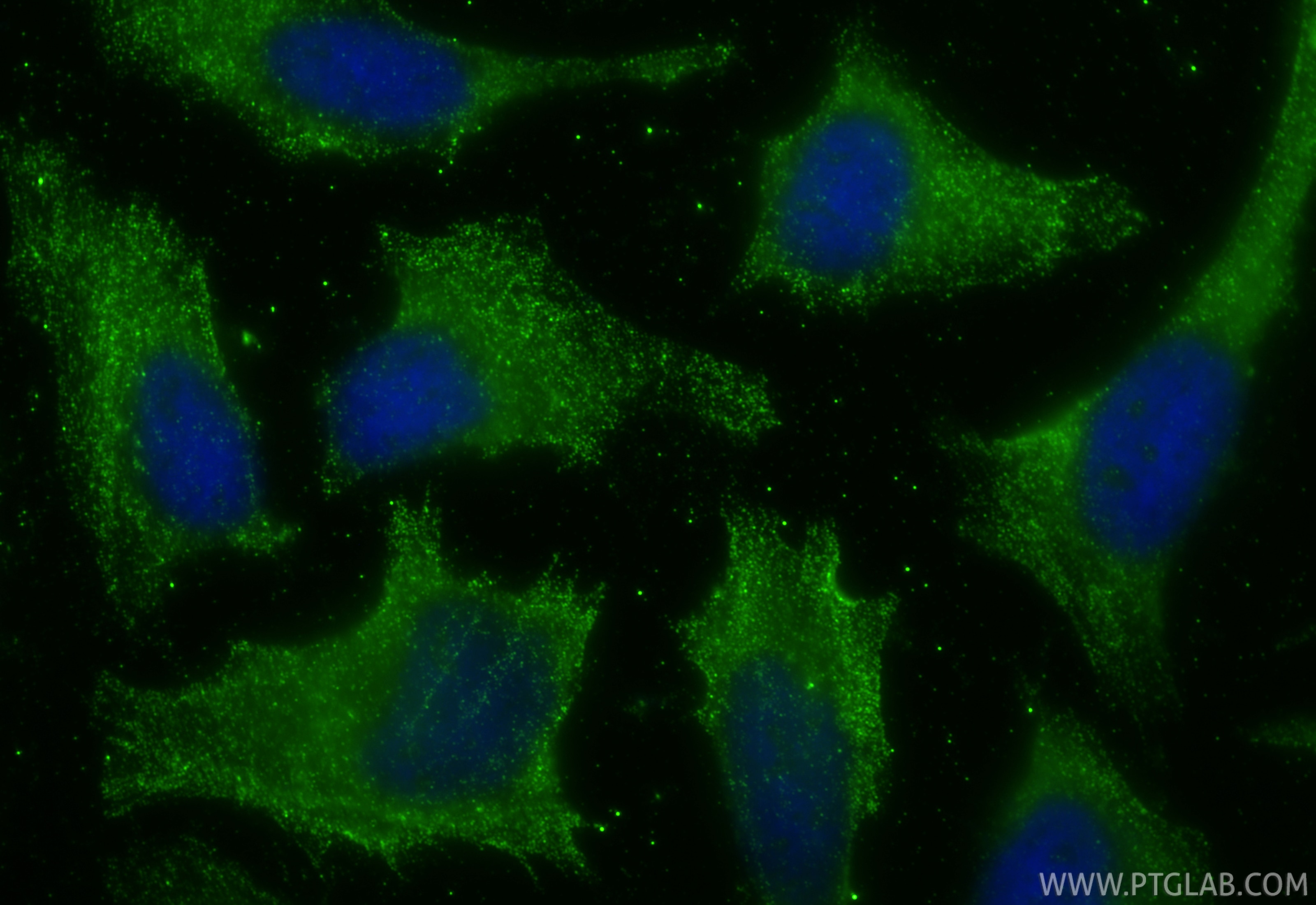 Immunofluorescence (IF) / fluorescent staining of HeLa cells using ASC/TMS1 Monoclonal antibody (67494-1-Ig)
