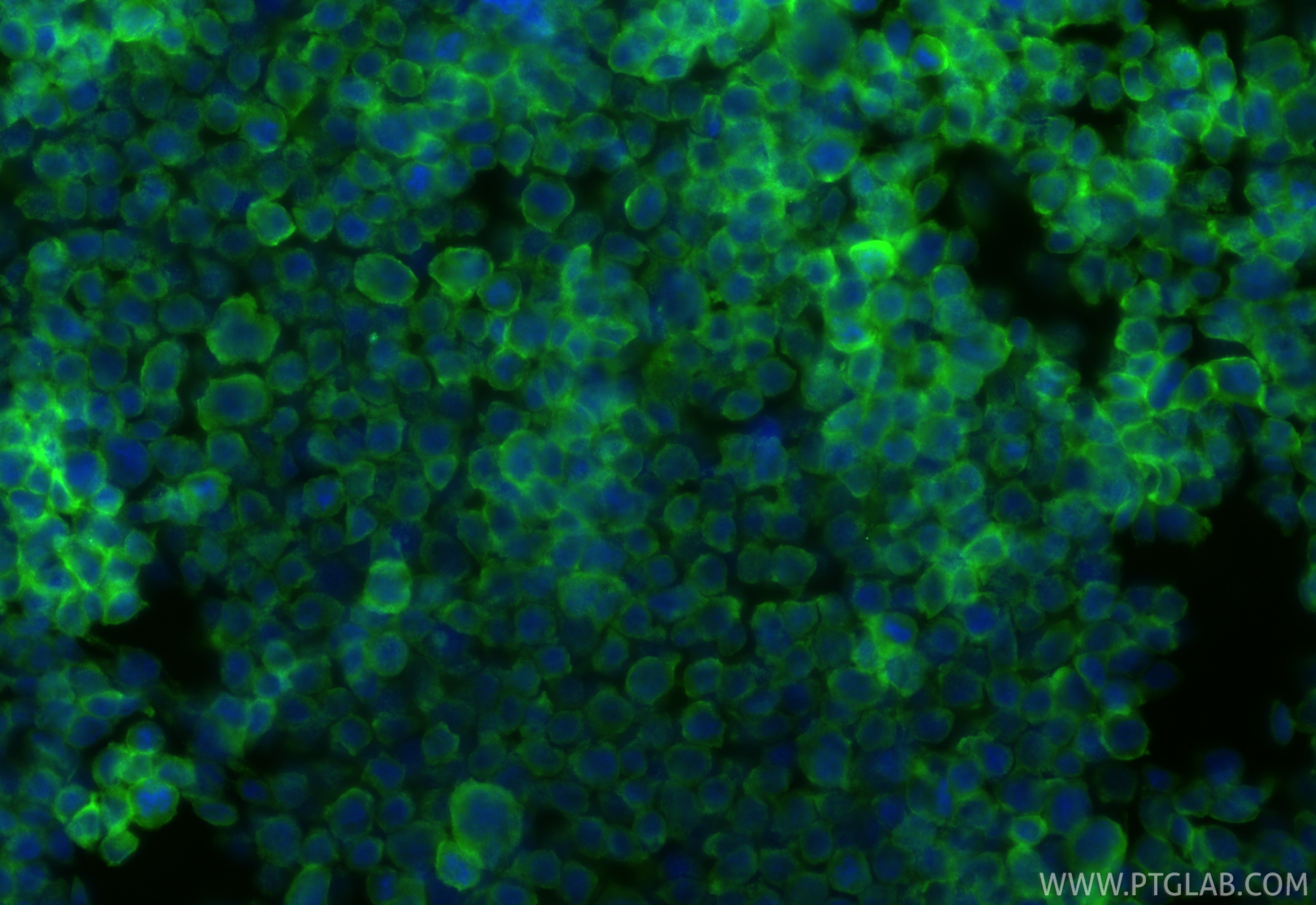 Immunofluorescence (IF) / fluorescent staining of THP-1 cells using ASC/TMS1 Monoclonal antibody (67494-1-Ig)