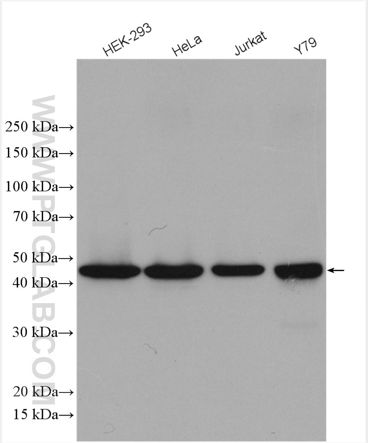 Western Blot (WB) analysis of various lysates using ASCC1 Polyclonal antibody (12301-1-AP)
