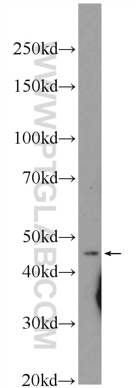 ASCC1 Polyclonal antibody