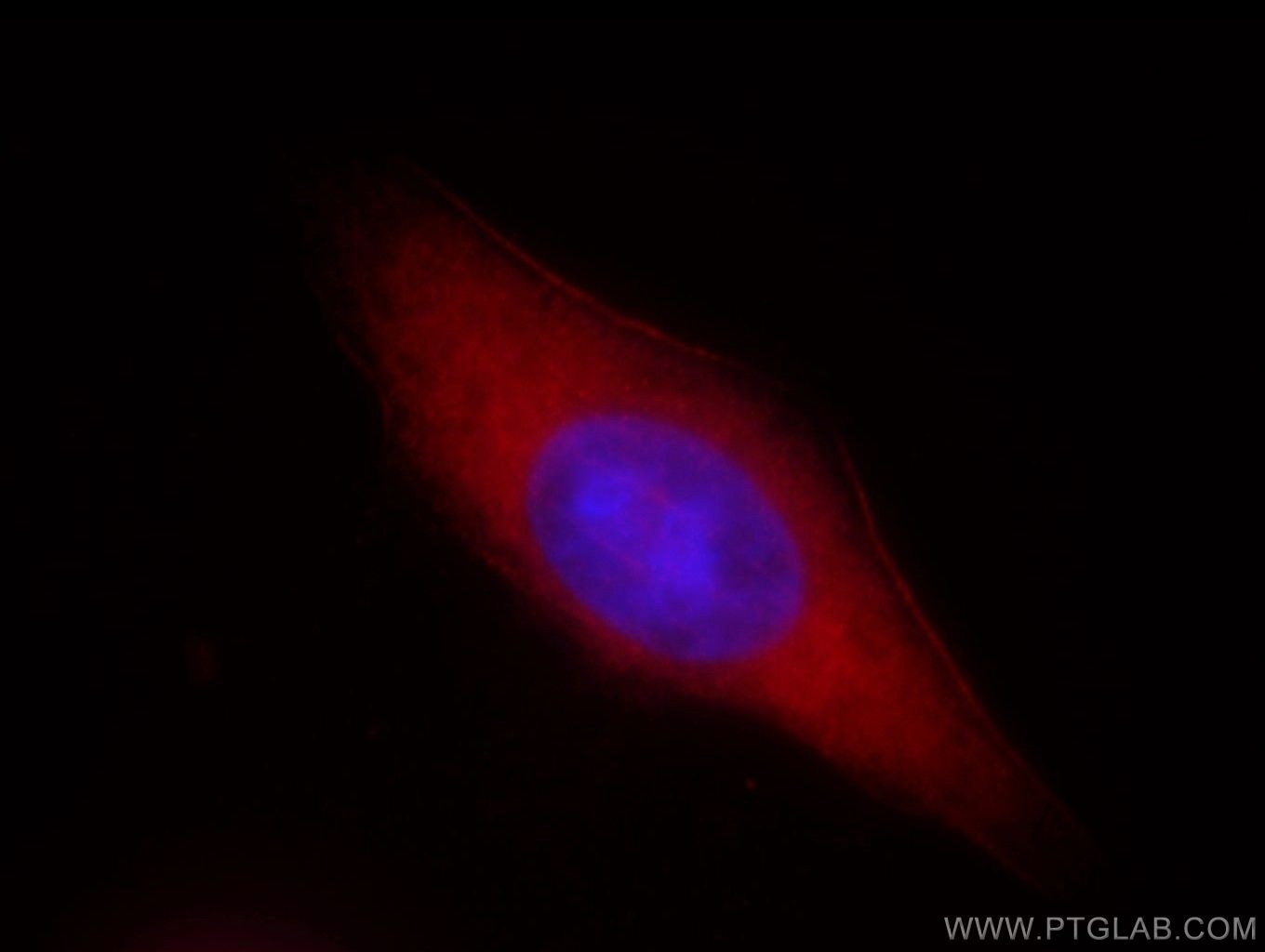 Immunofluorescence (IF) / fluorescent staining of HepG2 cells using ASCC2 Polyclonal antibody (11529-1-AP)