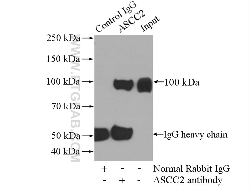 Immunoprecipitation (IP) experiment of HeLa cells using ASCC2 Polyclonal antibody (11529-1-AP)