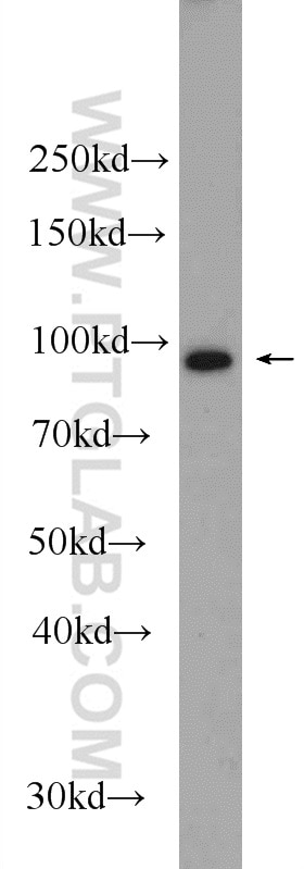 Western Blot (WB) analysis of HeLa cells using ASCC2 Polyclonal antibody (11529-1-AP)