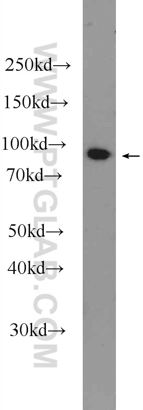 Western Blot (WB) analysis of mouse colon tissue using ASCC2 Polyclonal antibody (11529-1-AP)