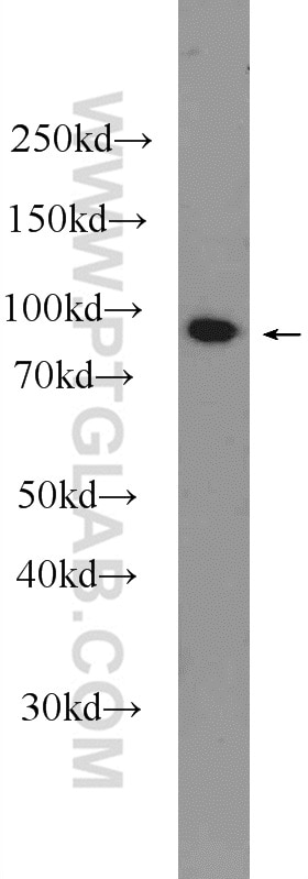 WB analysis of mouse colon using 11529-1-AP