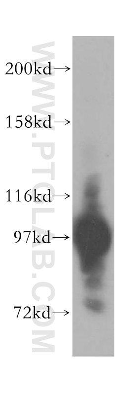 Western Blot (WB) analysis of human colon tissue using ASCC2 Polyclonal antibody (11529-1-AP)
