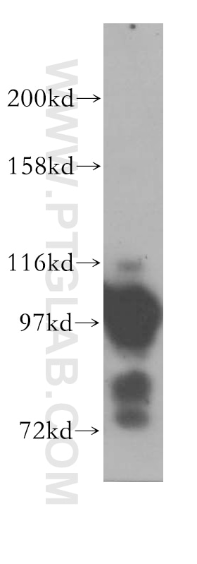 Western Blot (WB) analysis of human brain tissue using ASCC2 Polyclonal antibody (11529-1-AP)