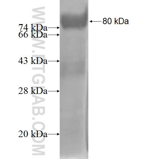 ASCC2 fusion protein Ag2100 SDS-PAGE