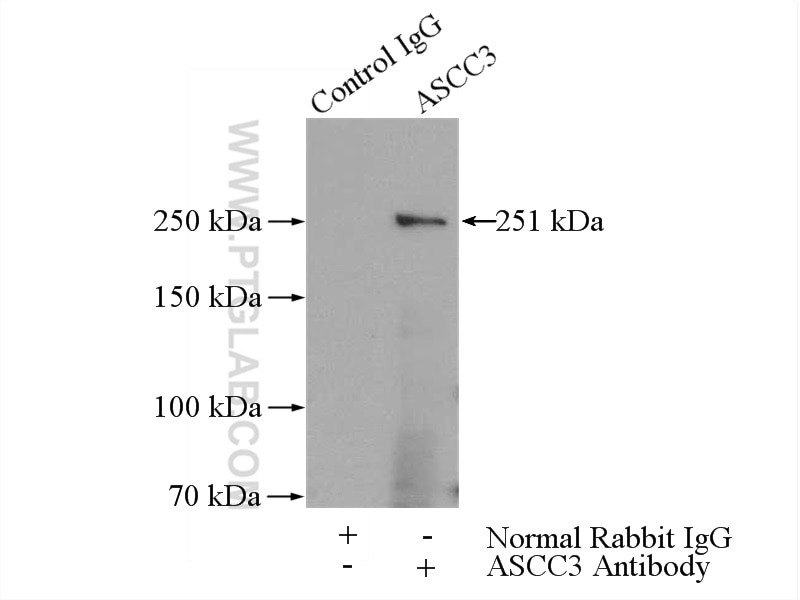 Immunoprecipitation (IP) experiment of HeLa cells using ASCC3 Polyclonal antibody (17627-1-AP)