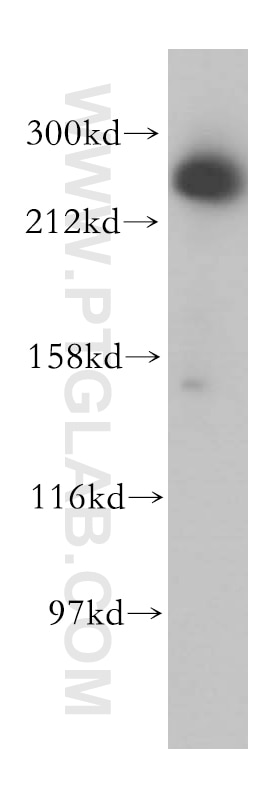 Western Blot (WB) analysis of HeLa cells using ASCC3 Polyclonal antibody (17627-1-AP)