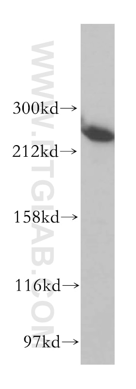 Western Blot (WB) analysis of HepG2 cells using ASCC3 Polyclonal antibody (17627-1-AP)