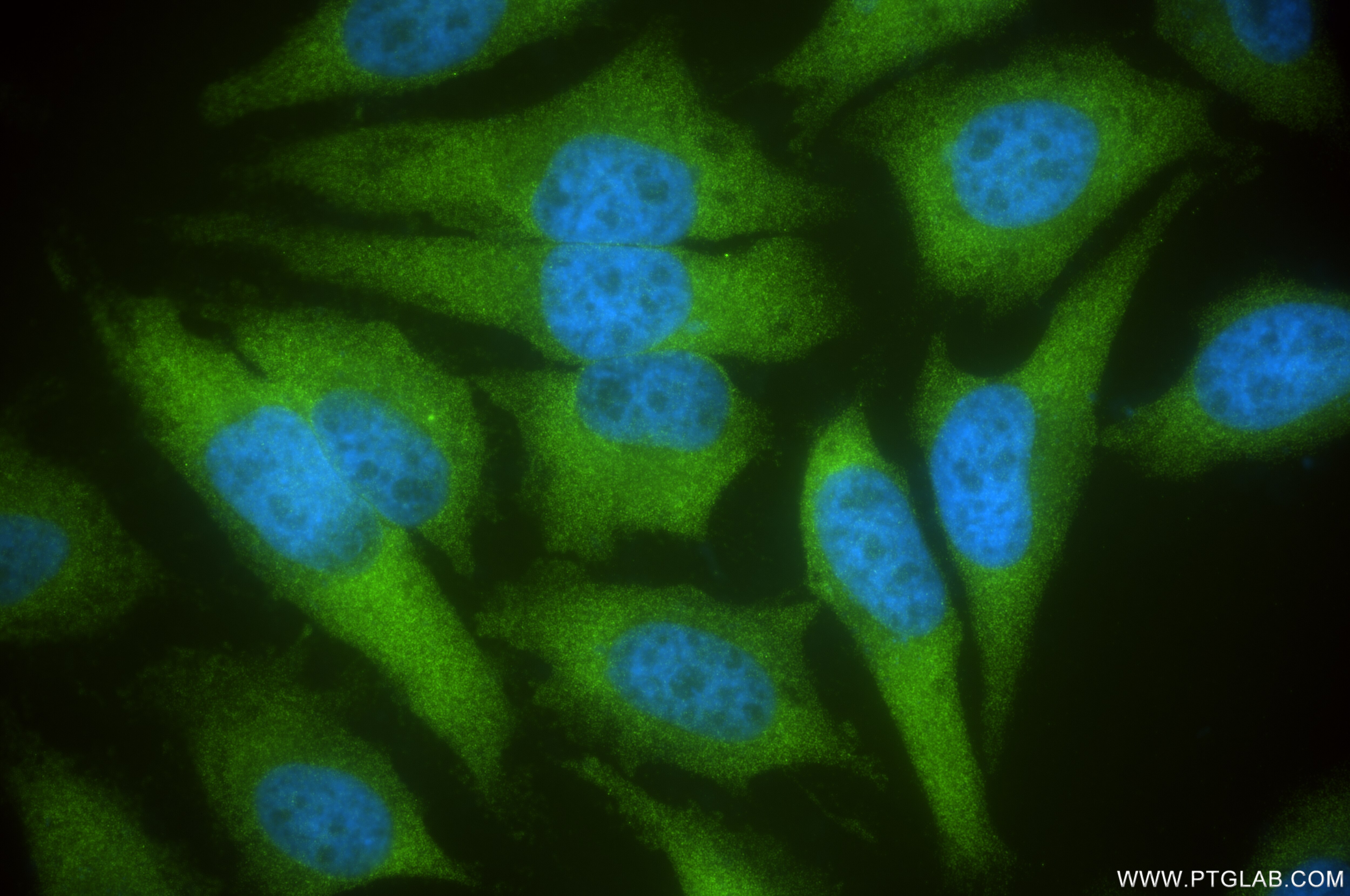 Immunofluorescence (IF) / fluorescent staining of HeLa cells using ASCC3 Recombinant antibody (85130-2-RR)