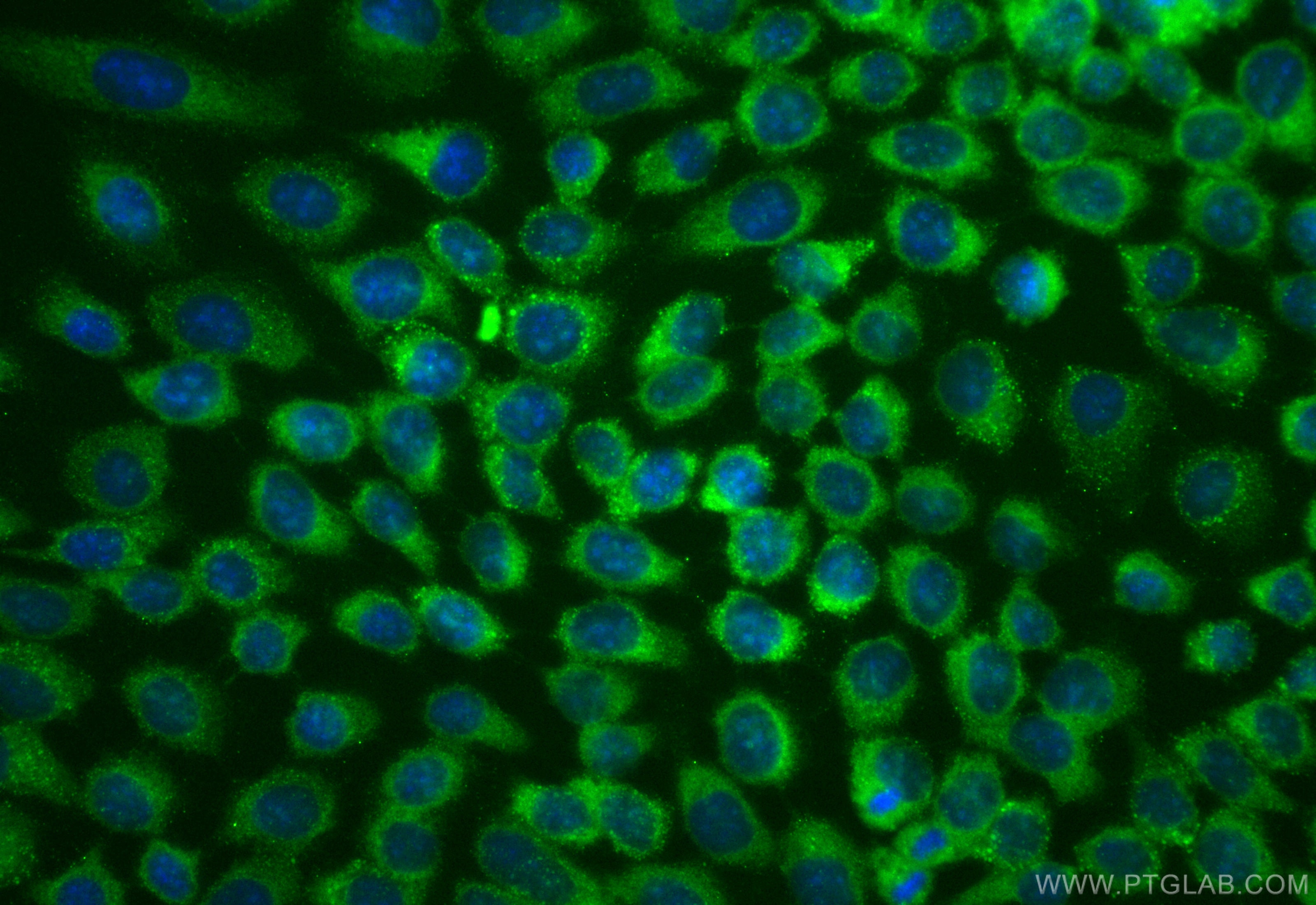 Immunofluorescent analysis of (-20°C Methanol) fixed A431 cells using CoraLite® Plus 488 ASCC3 antibody (CL488-85130-2, Clone: 242755B4 ) at dilution of 1:200. Immunofluorescence (IF) / fluorescent staining of A431 cells using CoraLite® Plus 488-conjugated ASCC3 Recombinant mo (CL488-85130-2)