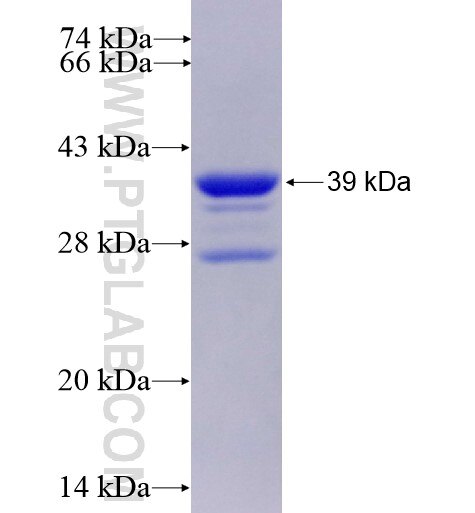 ASCC3 fusion protein Ag11848 SDS-PAGE